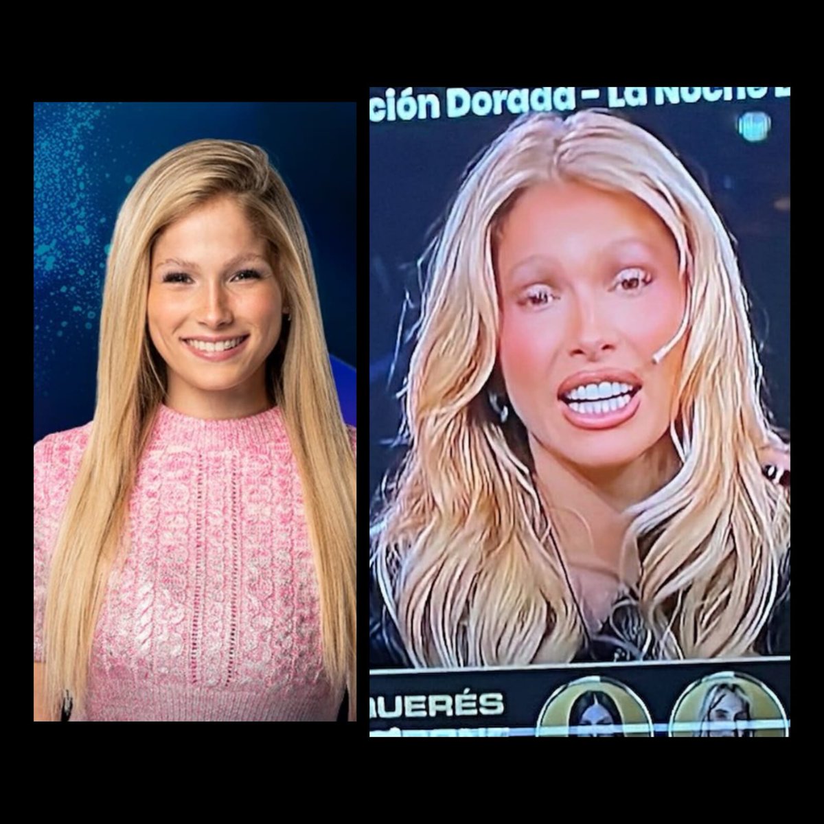 ladymoskigna's tweet photo. Prohíban de una vez por todas el botox, las carillas y el exceso de hialurónico en este país. 

NO LO PUEDO CREER https://t.co/Z9QxbFOk6E