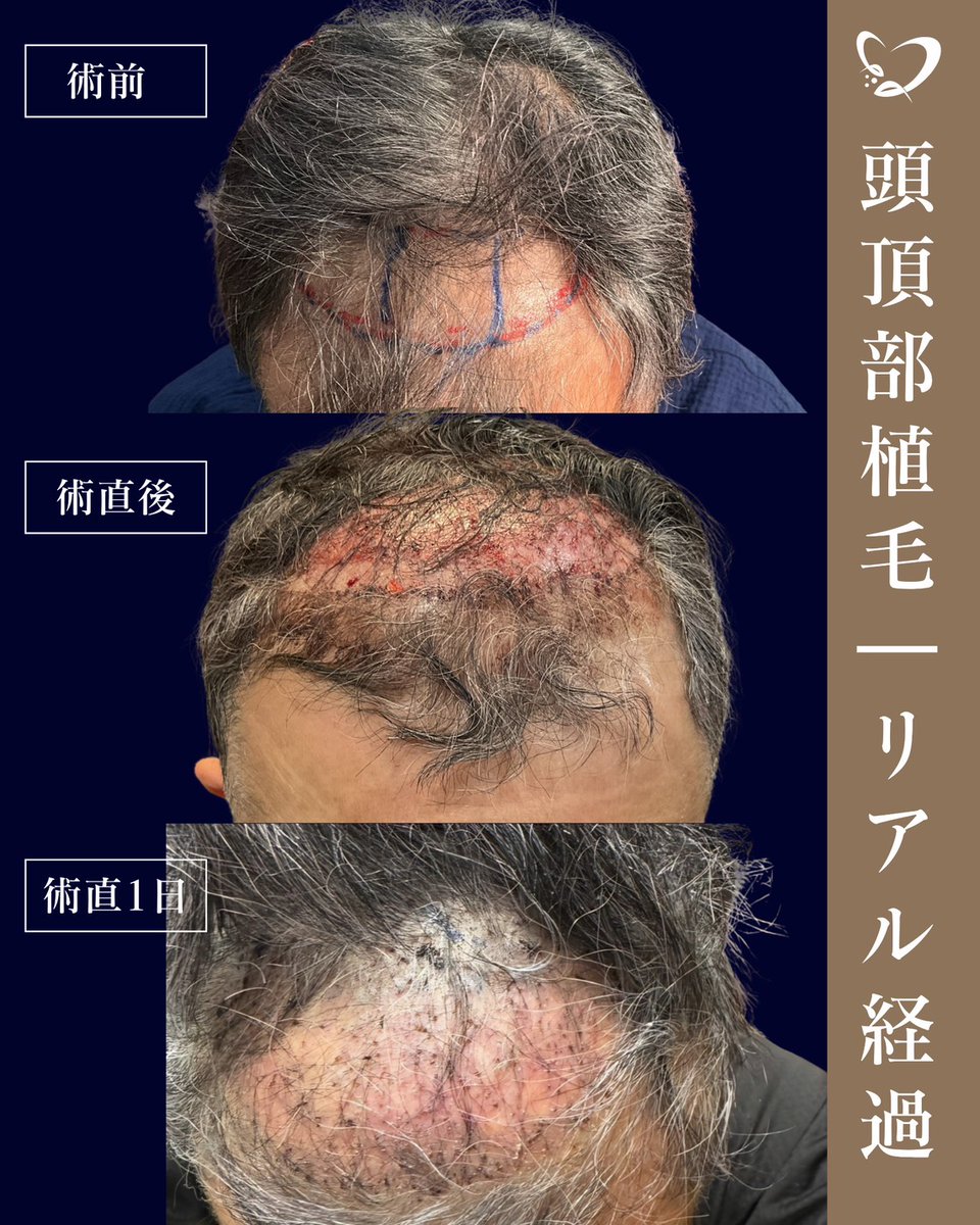 ヘアケアクリニック六本木 公式 tweet media