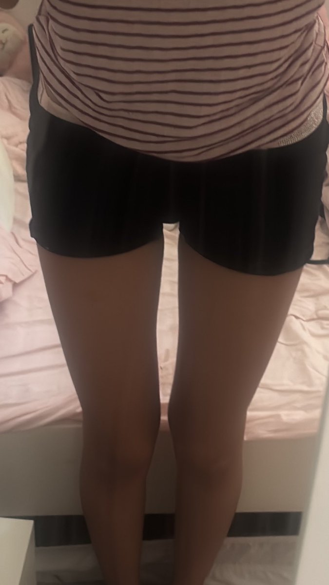 qodessstreet's tweet photo. thigh gap when knees aren’t touching vs when knees are touching !!! 
🐁👾🩷

#edrtwt #shedtwt #edtwt ana https://t.co/WrvZGfA4Nv