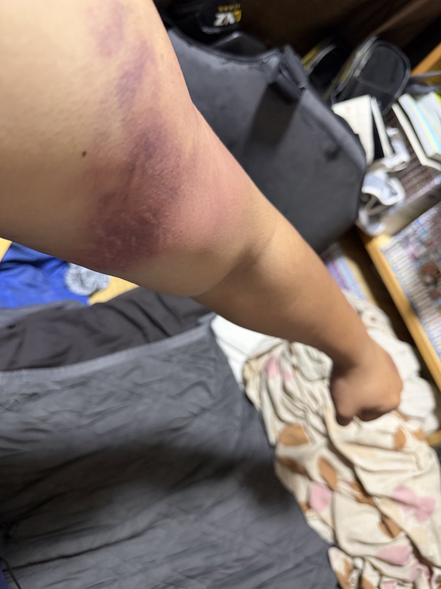 serary06's tweet photo. 中学の頃の同級生と再開したらやることは肩パン耐久 https://t.co/wCZ6dVp4ov