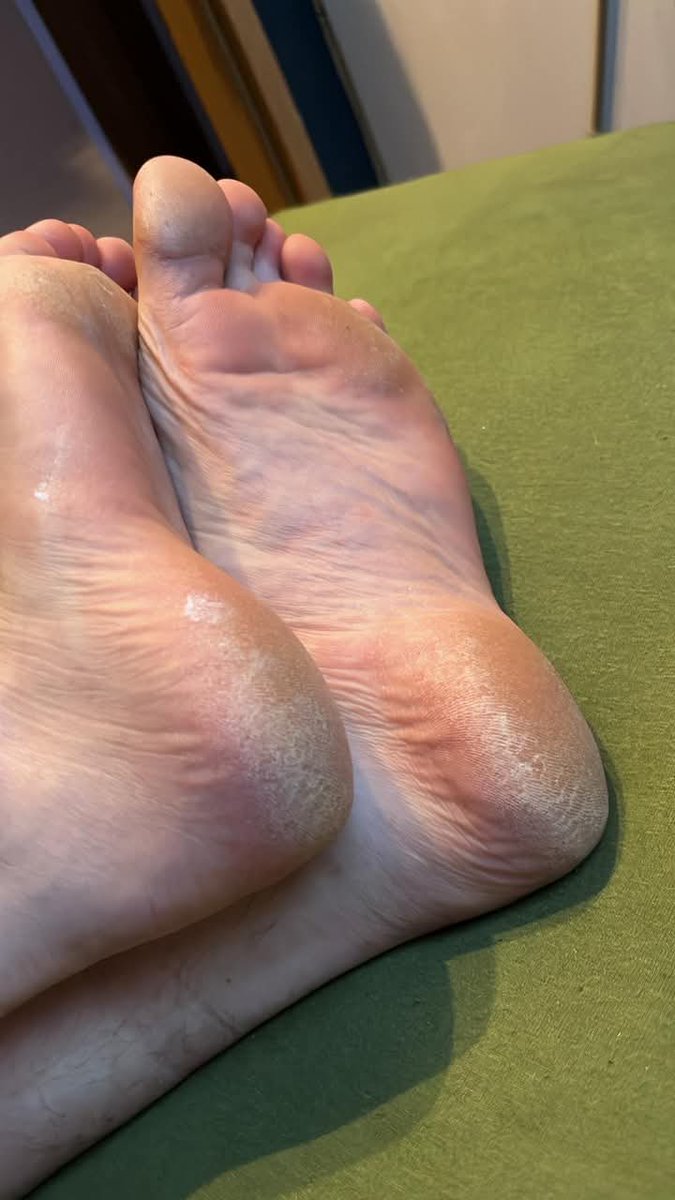 runnershighde's tweet photo. Gleich eine rießen Portion Hornhautpulver ernten damit ihr Schwulleten was zum fressen habt!! #findom #zahlschwein #feetworshi̇p #feetfetısh #master #alpha https://t.co/WI5XLgEMMG