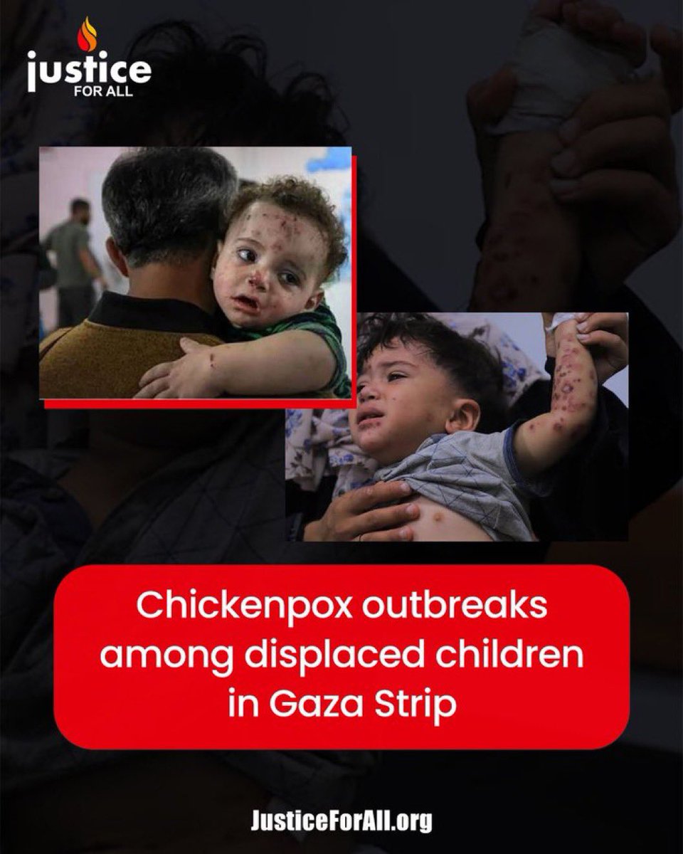 shameensuleman's tweet photo. 🟥 UPDATE NUMBER ONE | 11 JULY 2026

🔳 Sources: Palestinian Ministry of Health – Gaza | Journalists on the Ground

🟥 GAZA

🔳 The Palestinian Ministry of Health has warned that Gaza’s transport and ambulance system is approaching complete collapse. What remains of the transport and ambulance fleet is no longer capable of meeting daily needs. Around 70% of vehicles have been taken out of service, either after being directly targeted by israeli attacks or through accumulated mechanical failures made worse by the continued denial of spare parts.

▪️The Ministry says it is becoming increasingly difficult to transport both patients and healthcare workers, with no safe alternatives available. It warned that the continued prevention of tyres and spare parts entering Gaza could result in the complete paralysis of the medical transport system, placing even greater pressure on hospitals already operating under extreme conditions.

▪️Buses operated by transport companies contracted by the Ministry of Health are also functioning under severe mechanical strain. Routine maintenance has been suspended for months because replacement parts remain unavailable. The Ministry warned that any further disruption to transport services will directly affect the ability of medical staff and patients to reach healthcare facilities.

🔳 The Palestinian Ministry of Health has released its latest casualty figures covering the past 48 hours.

▪️Hospitals across Gaza received 7 martyrs (6 newly killed and 1 body recovered from beneath the rubble) and 28 injuries.

▪️The Ministry again stressed that many victims remain trapped beneath the rubble or lying in the streets, while ambulance and Civil Defence crews remain unable to reach them.

🔳 Since the ceasefire of 11 October:

▪️1,098 martyrs
▪️3,535 injuries
▪️800 recovery operations

🔳 Since 7 October 2023:

▪️73,221 martyrs
▪️173,643 injuries

▪️The Ministry also confirmed that 96 additional martyrs have been added to the cumulative death toll after their identities and records were completed and formally verified by the Martyrs Verification Committee during June.

🔳 The Ministry of Health has invited media organisations to attend an important press conference on the worsening transport and ambulance crisis.

▪️The conference will take place on Sunday, 12 July 2026, at 10:00am, outside the Central Transport Station for Ambulance and Emergency Services beside Palestine Stadium in Gaza City, where officials are expected to outline the consequences of the collapsing transport network on Gaza’s healthcare system.

🔳 Four-year-old Little Sonds is suffering from chickenpox, becoming one of the latest faces of Gaza’s deepening public health emergency.

▪️Thousands of cases of chickenpox are now being reported across refugee camps and displacement centres throughout the Gaza Strip. Medical and international organisations have warned of a rapidly expanding outbreak driven by extreme overcrowding, the collapse of sanitation systems, limited access to clean water, and severe shortages of medicines.

▪️For most children around the world, chickenpox is a manageable childhood illness. In Gaza, where healthcare has been systematically devastated and families are living in overcrowded tents with little protection from disease, even common infections can quickly become life-threatening, particularly for young children, pregnant women, and those with weakened immune systems. The outbreak adds another layer to the humanitarian and healthcare crisis already overwhelming the Strip.