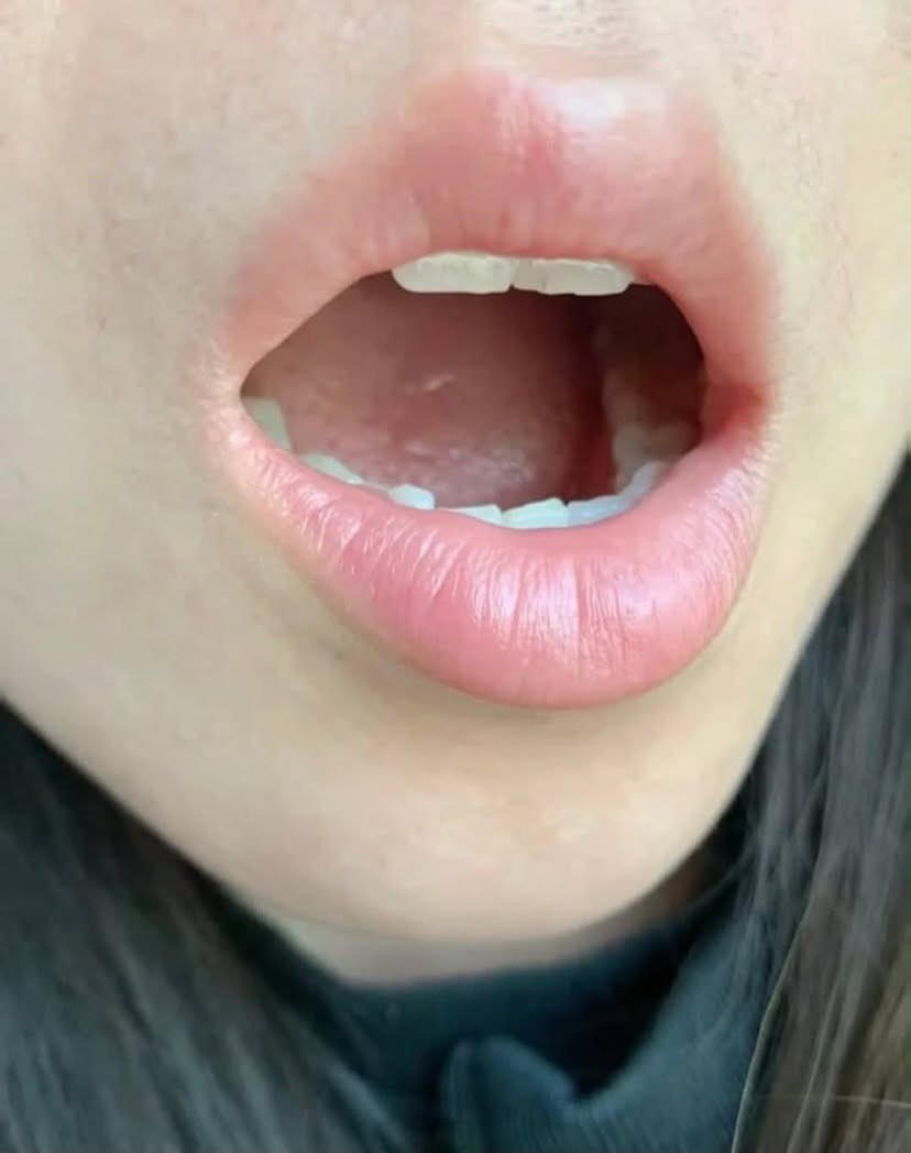 nadaa02e's tweet photo. MAKASIH BANGET YANG UDAH NGASIH TAHU INI 🫵🏻😭
Beneran works banget buat merawat bibir! Dulu malu banget pake lipstik gara-gara ini, sekarang malah rutin pakenya https://t.co/gdXaNlgYh3