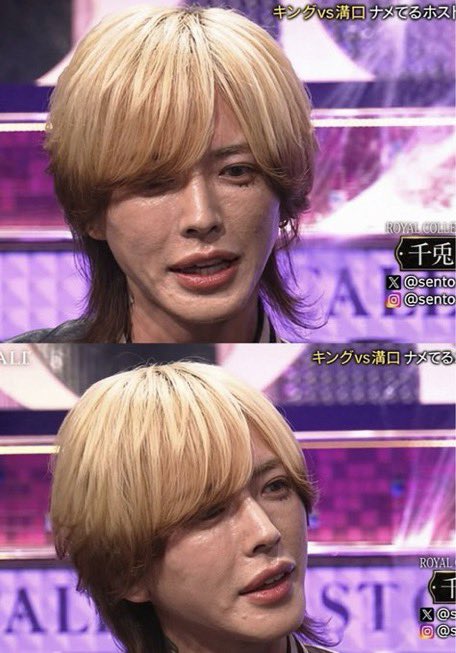 tomu_riddle's tweet photo. スト値あるけど、
なぜこんな人工的な皮膚になるのか https://t.co/XddptcRqXv
