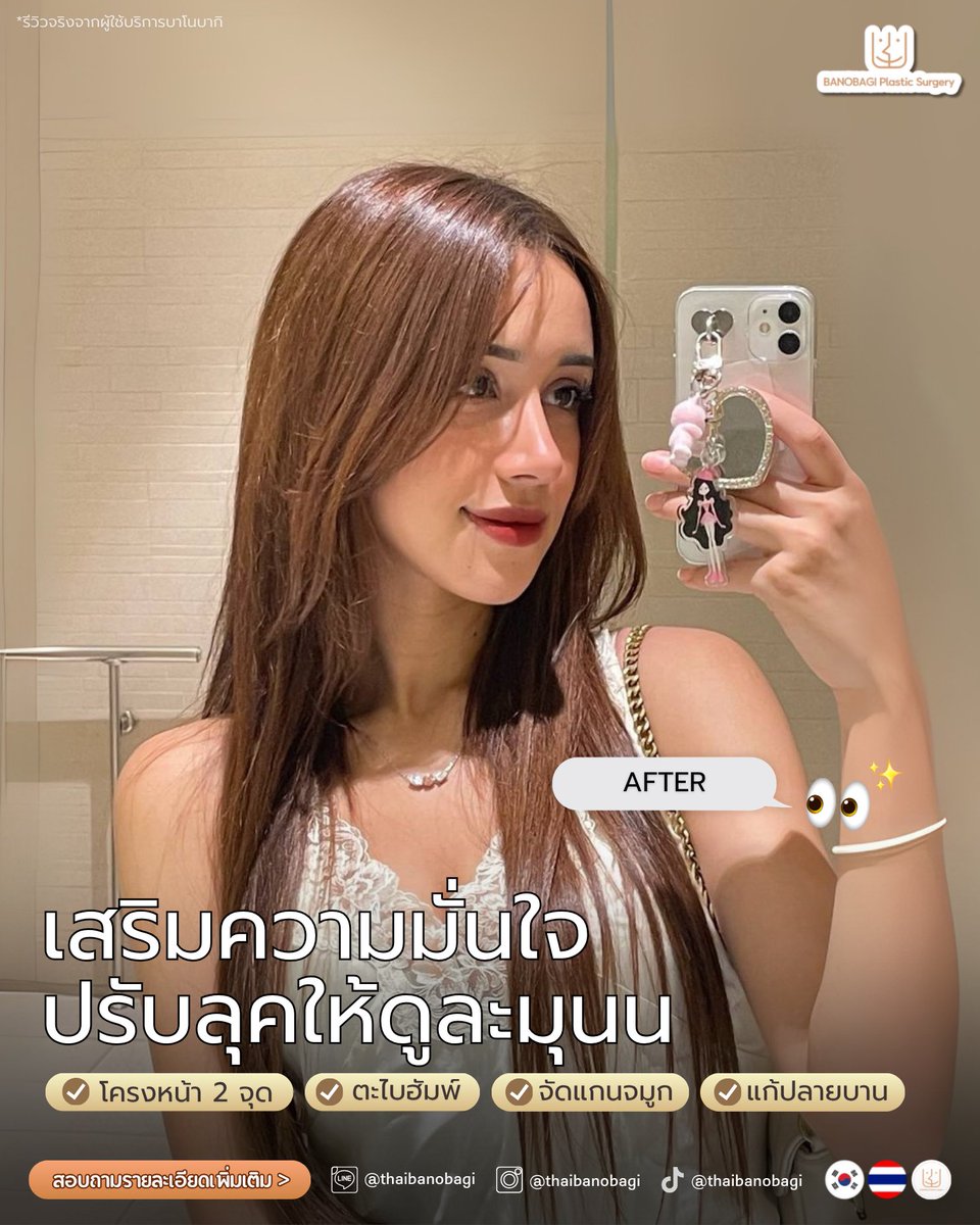 banobagithai's tweet photo. จากหน้าดุ เป็นหน้าละมุนในครั้งเดียว 🤍✨
🗯️ โครงหน้า 2 จุด (กราม+คาง)
🗯️ ตะไบฮัมพ์จมูก
🗯️ จัดแกนจมูก
🗯️ แก้ปลายจมูกบาน

#รีวิวศัลยกรรม #BeforeAfter #โครงหน้า #VLine #ตะไบฮัมพ์ https://t.co/Vb2V3TO9FA