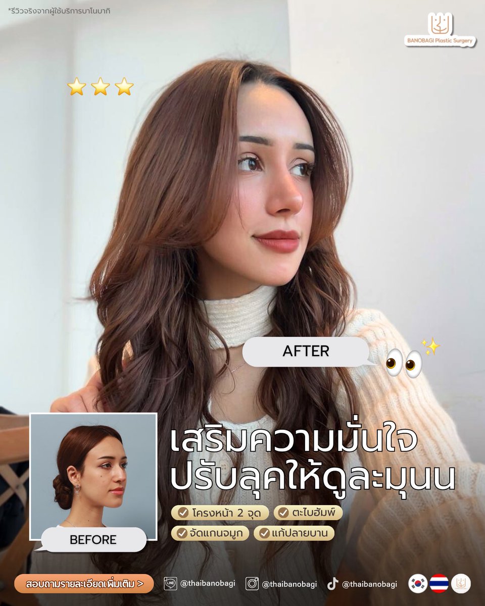 banobagithai's tweet photo. จากหน้าดุ เป็นหน้าละมุนในครั้งเดียว 🤍✨
🗯️ โครงหน้า 2 จุด (กราม+คาง)
🗯️ ตะไบฮัมพ์จมูก
🗯️ จัดแกนจมูก
🗯️ แก้ปลายจมูกบาน

#รีวิวศัลยกรรม #BeforeAfter #โครงหน้า #VLine #ตะไบฮัมพ์ https://t.co/Vb2V3TO9FA