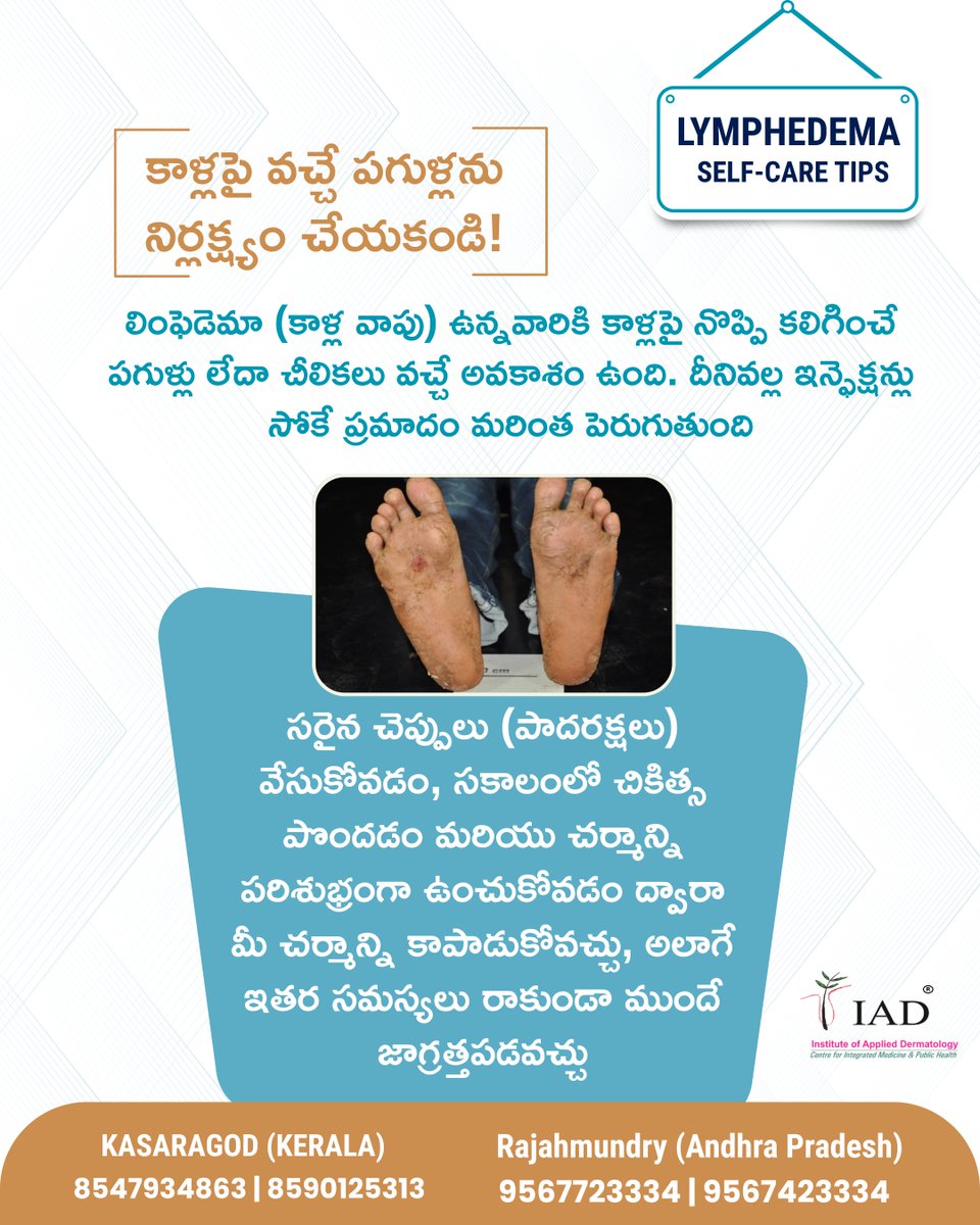 iadorgin's tweet photo. బోధ కాలు, ఏనుగు కాలు, ఫైలేరియాసిస్ చికిత్స, గుంటూరు,రాజమండ్రి, రాజమహేంద్రవరం, ఆంధ్రప్రదేశ్

IAD Rajahmundry, Andhra Pradesh
82-19-1, Near Laxmi Devi Temple, AVA Road, Rajahmundry, Andhra Pradesh - 533103
For appointments: 9567723334 | 9567423334
@MoHFW_INDIA @moayush https://t.co/DDUZpS9jvg