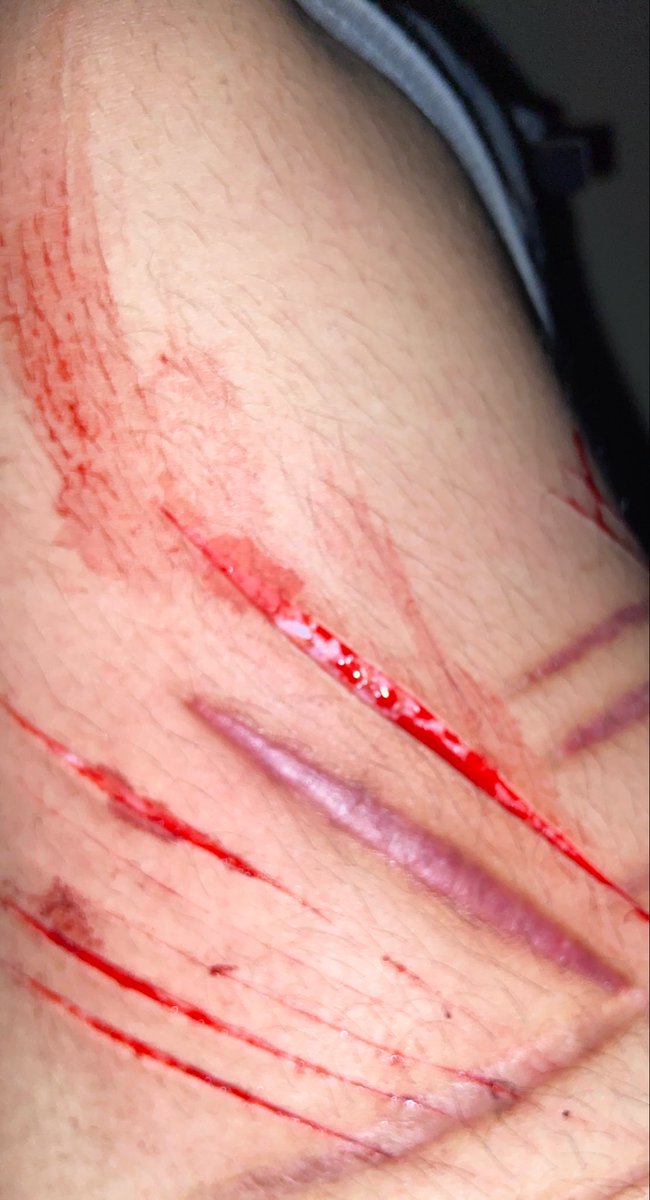 milkbonebites89's tweet photo. its sooooo hard to love me right !!!  but i think this one is kinda pretty 

sh sh small cut https://t.co/fpxafeAt6b