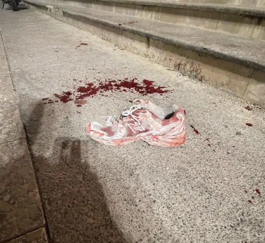 _A_khalifa's tweet photo. Send this shoe to the
white Western liberal!

Maybe his dumb brain
can finally comprehend the
scale of the massacre the
mullahs carried out against Iranians! https://t.co/eoIbehUrq8