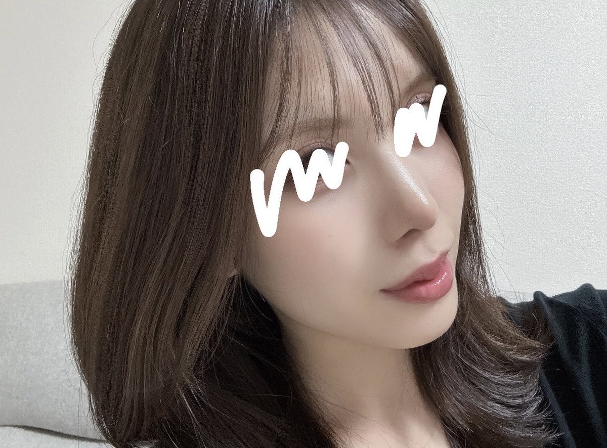 wUx9Wegb8YIpIhC's tweet photo. コード整形外科さん（@codeps_jp ）で鼻整形してから2ヶ月目!!
もう十分完成って言えるぐらい綺麗になった✨
肋軟骨の痛みも1ヶ月目くらいから全くなくて、今はもう生活になにも支障がないくらい✌🏻
今までは写真上げる時、鼻の加工マストだったけど今は何もしなくなったの本当嬉しい。 https://t.co/vdTbYiRoik
