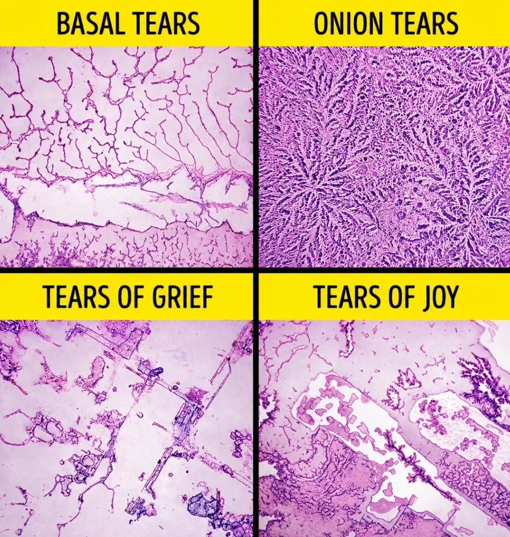d_fib's tweet photo. All about tears..!!
#tears #pain #eyes #joy #grief https://t.co/tLIATnylLR