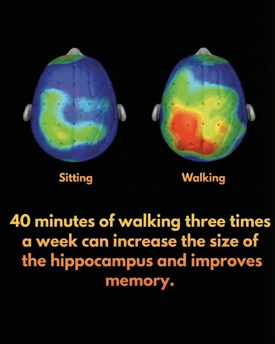 SmartScience's tweet photo. 🧠 Brain scans show that just 40 minutes of walking literally improves brain function.

Which is not great, given how sedentary modern humans have become — at least in the US and much of Europe. 

 Research into cognitive performance reveals a stark contrast between sitting still and active movement. 

While a sedentary state shows minimal neural activity, light walking immediately ignites neural pathways, significantly boosting focus and creativity. These brain scans prove that movement isn't just about fitness—it is a vital tool for unlocking mental clarity and sharper thinking in our daily lives.

The implications for our cities are profound.

Car-dependent urban design traps us in sedentary cycles, fueling global rises in obesity and cardiovascular disease. However, by redesigning our communities to be walkable and bike-friendly, we can bake health into our daily routines. Prioritizing pedestrian infrastructure over vehicle traffic doesn't just clear the air; it builds stronger communities and healthier minds, proving that the way we design our world determines how well we live in it.

Source: Hillman, C. H., Pontifex, M. B., Raine, L. B., Castelli, D. M., Hall, E. E., & Kramer, A. F.. The Effect of Acute Treadmill Walking on Cognitive Control and Academic Achievement in Preadolescent Children. Pediatrics.