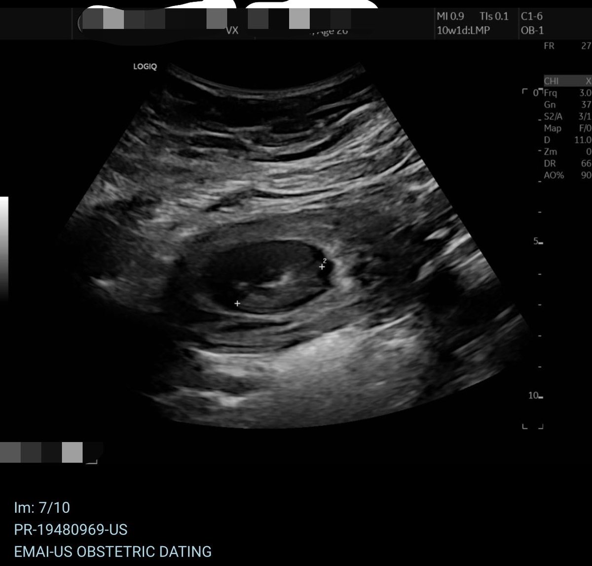 catleysbatlle's tweet photo. I’ve been keeping a secret 🤭🤭 
another little Arsenal fan coming 2027 🩶 https://t.co/mGWsKkpeEM