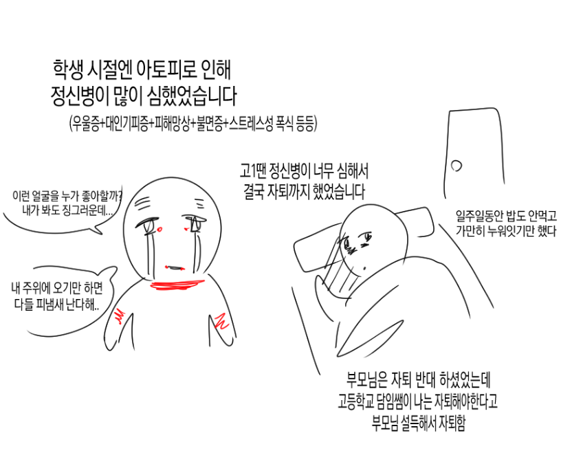 J13K0's tweet photo. 아토피 이야기2 https://t.co/JmFx5PhPSy