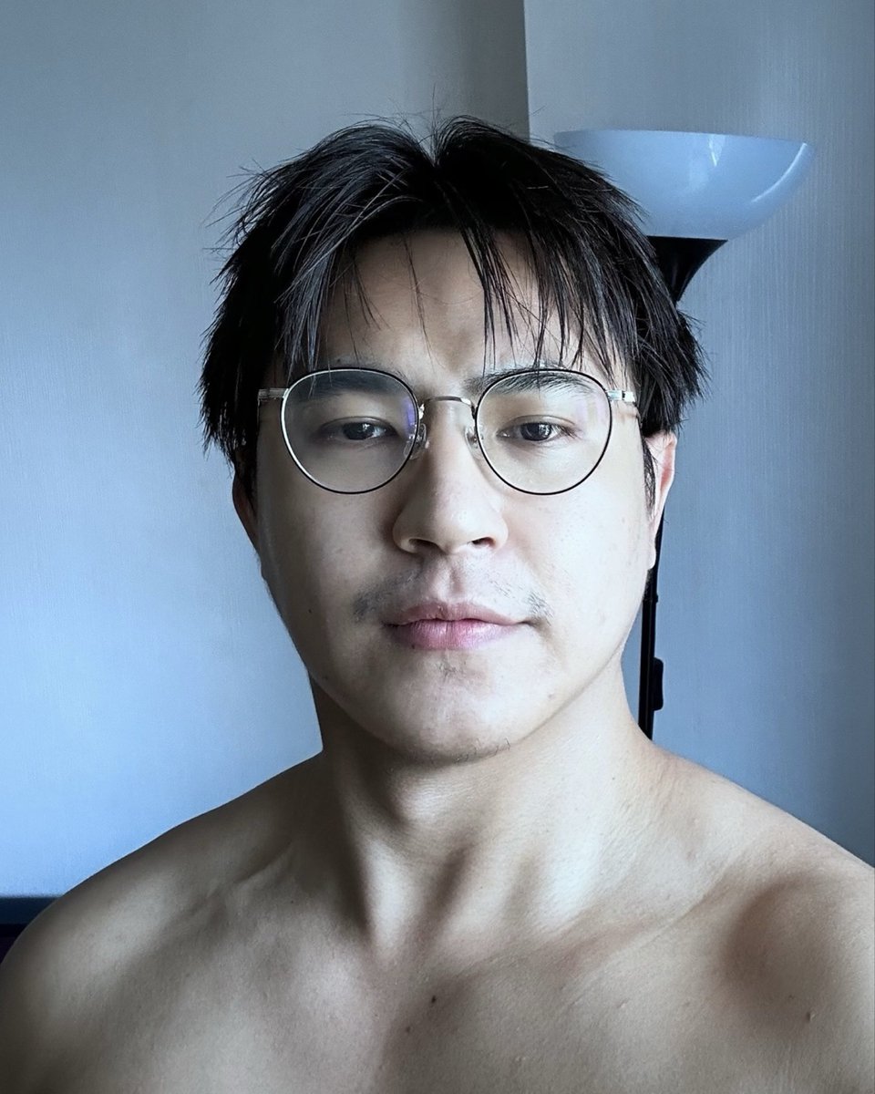 NtrioCK's tweet photo. จากรูปแรก 2019 จนถึงปัจจุบัน
เริ่มหันมาดูแลตัวเอง
- ออกกำลังกาย อย่างน้อย 5 ชม. ต่อสัปดาห์ (เพราะต้องการเพิ่มน้ำหนัก)
- ทาครีม ทุกวัน เช้า - ก่อนนอน
- หัตการมีทำเลเซอร์ Q-Switch  2 เดือนครั้ง

หลักกาารคือทำจนชิน ทำจนเป็นนิสัย

ตอนนี้คิดว่าต้องเริ่มหา Botox บ้างแล้ว ยังไม่เคยฉีดใครมีคลินิกที่ไว้ใจแนะนำได้ครับ