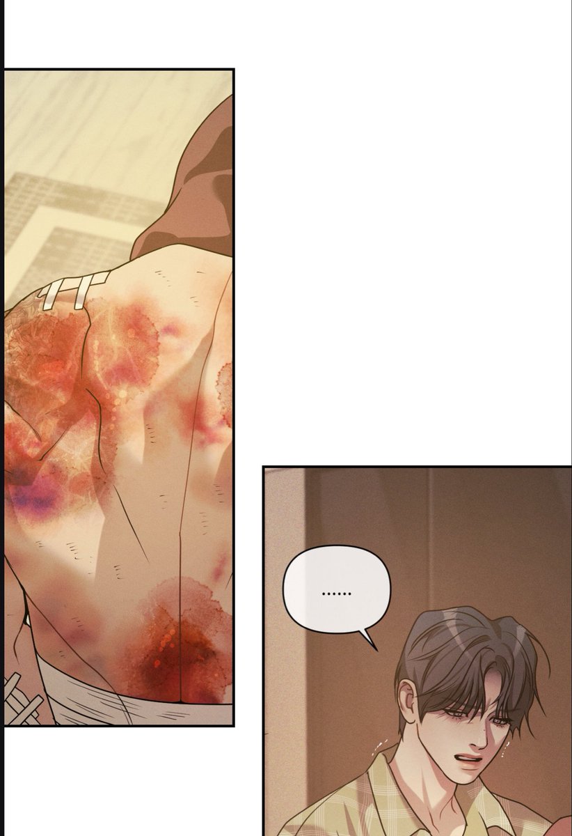 iliachava28's tweet photo. The fact that only scars Seunghyun has are burn scars he got while protecting Yuta (alsotryingtokillhimself)is so romantic🫠💔also the whole “Seunghyun is perfect” narrative is finally broken
#조개소년발화 #ignitethedawn https://t.co/otmTzARz17