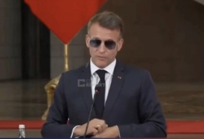 Pascal_Laurent_'s tweet photo. 🇫🇷 MANU LA GRATTOUILLE...
Kéké Rose est-il en train de devenir un junkie ? La question se pose, les yeux rouges ou "ensanglantés" chez les toxicomanes résultent principalement de la dilatation des vaisseaux sanguins de l'œil (hyperhémie conjonctivale). Fréquents avec le cannabis ou la cocaïne, ils peuvent aussi s'expliquer par l'injection intraveineuse, le manque d'hygiène ou des produits de coupe irritants. 
De plus les toxicomanes se grattent en raison de réactions physiologiques directes aux substances (notamment les opiacés), d'hallucinations tactiles, de troubles obsessionnels, ou lors du syndrome de sevrage.