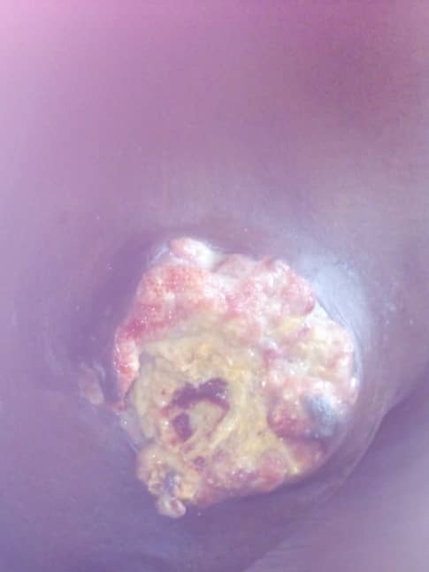 emzy4ya's tweet photo. Please guys my wife has a breast tumor and I need to get her drugs which cost #39500 if I can get this drugs that will last her a month which is 79k by then I would have raised enough to continue. Please I need this help
7045204577
Monie point 
Emmanuel onu 🙏🙏🙏 https://t.co/IcJUszAv15