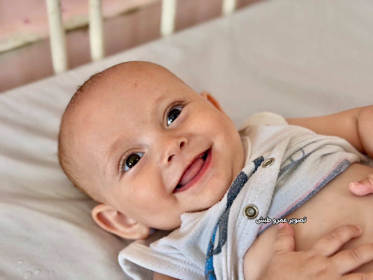 MalaMimalamy's tweet photo. أنقذوها قبل أن تختفي ضحكتها البريئة…
تعيش الطفلة الرضيعة روضة أبو زرقة، البالغة من العمر 7 أشهر ونصف، معاناة قاسية مع أمراض خطيرة تهدد حياتها، إذ تعاني من تضخم في الكبد، إلى جانب ضعف شديد في النمو، وصعوبة في الرضاعة، ونوبات متكررة من الانخفاض الحاد في مستوى السكر في الدم، https://t.co/LYpopJGCfg