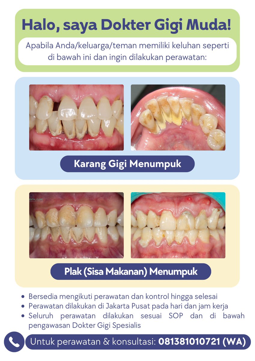 nlndiva's tweet photo. Haihaloo, aku koas gigi Jakarta!
Bagi yang punya keluhan karang gigi menumpuk dan ingin SCALING, boleh chat aku yaahh 😆✨
☎️ 081381010721

#koasgigi #koasgigijakarta #perawatangigigratis #caripasien #psagigi #scalinggigi #scalinggratis #scaling #caripasienkoasgigi #koaslife https://t.co/yBUJvXtgAG