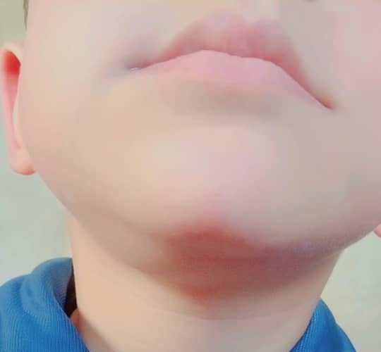 zaid__hassn's tweet photo. الطفل فادي بحاجة عملية لاستئصال كتلة في الفك بكلفة 700$  
يمكنكم المساهمة لو بالقليل فالقليل عند الله كثير https://t.co/4fNOyH48x6