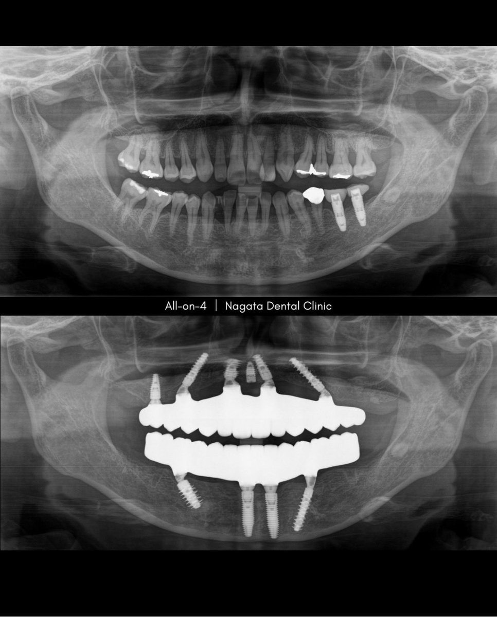 ore_dentist's tweet photo. さすがにこれはやりすぎやろ、、、 https://t.co/UH0lqcXdFV