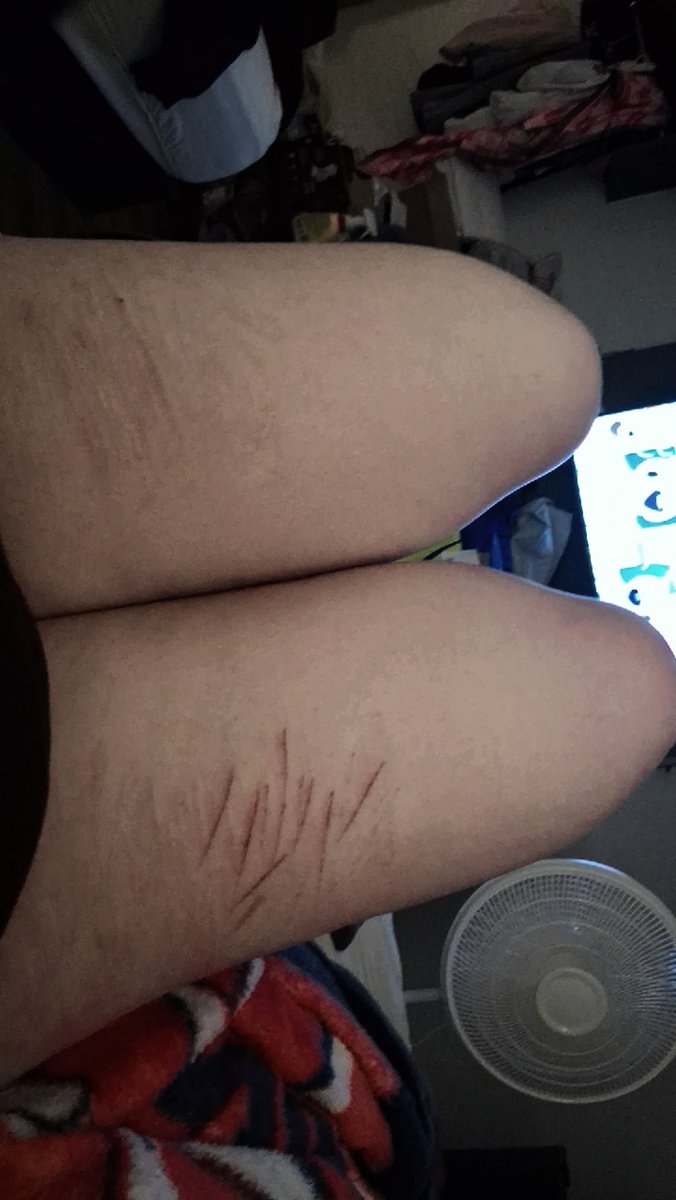 angelwingssbfy's tweet photo. @jiuumiii These are the deeper layer of skin (I dunno how to spell it😭) https://t.co/Qoi0wtsWhv