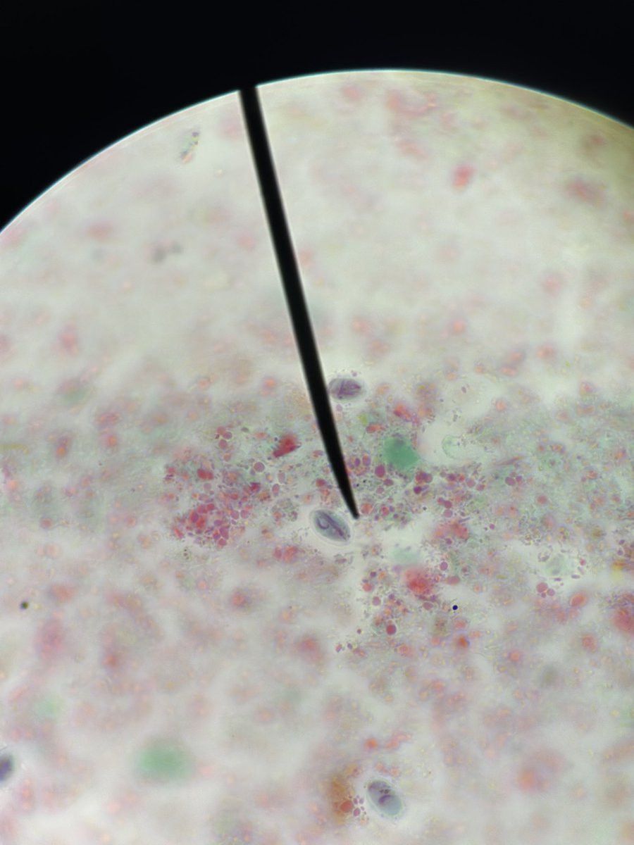 urgjean's tweet photo. Giardia lamblia https://t.co/l4yKI7rVOk