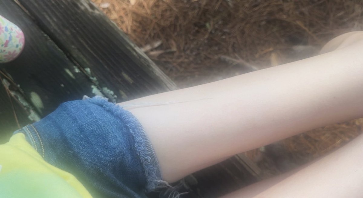 toothtakers's tweet photo. from my walk Ok🧁🍀 https://t.co/j8MZLyjrRp