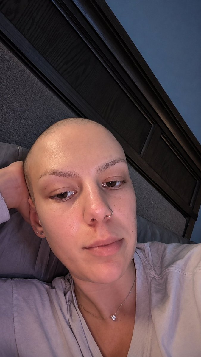 VictoriaMoaipu's tweet photo. The day I was diagnosed with brain cancer, everything changed.
I’m holding onto hope as I wait for the life-saving surgery I urgently need.
Please support or share my journey. Every act of kindness gives me strength. ❤️
https://t.co/0xY39b0m2q https://t.co/k0KXgBkTre