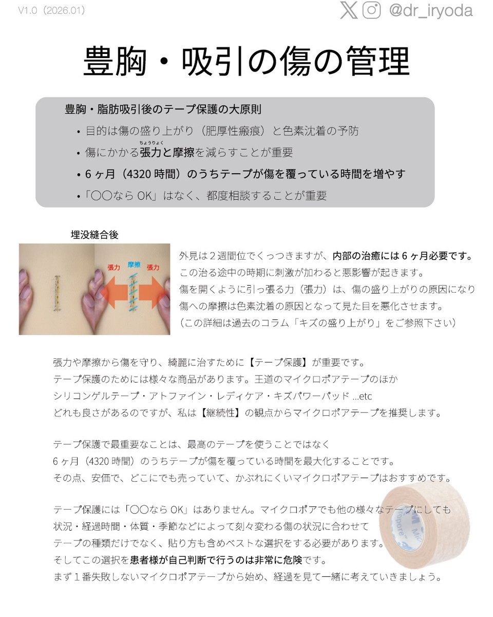 dr_iryoda's tweet photo. 私は自己判断での
リザベン予防内服には
【反対です】🙇

攻撃的な意図はなく
ただポストの拡散で
リザベンや柴苓湯が手元にないことを
不安に感じる患者様から
いくつか相談を頂いたので
念のため私的な意見をお伝えします🙇

リザベン（トラニラスト）は
いわゆる"傷の盛り上がり"である
肥厚性瘢痕（ひこうせいはんこん）や
ケロイドの治療薬です。

そのため
念のため先に飲んでおくことで
何らかの予防効果を期待する気持ちは
とても良く分かります💡

しかし実は
リザベンに関して
肥厚性瘢痕などを「予防する効果」は
認められていません😳

あくまでも
発生した肥厚性瘢痕を治療する薬であり
決して予防するエビデンスはありません

またそもそも
リザベンは肥厚性瘢痕に対する
「特効薬」のような薬ではありません

正直な臨床感覚としては
「飲まないよりはマシ」程度の効果だと
私は考えています🙇
（使用中の皆様申し訳ありません）

あくまで多くの治療法の1つで
外用薬・レーザー治療・テープ治療などと組み合わせて初めて意味がある治療だと思います👀

個人的には
リザベンを飲んでいたから傷が綺麗になった！という人は
飲んでいなくても綺麗だっただろうと思います🙇🙇🙇
そのくらいの認識です。

一方で
合併症である【膀胱炎】は
そこそこの頻度で発生します😱

ですから
リザベンの予防内服には
メリットはほとんどなく
【デメリットが目立つ】
という認識を持っています🙇

例えば
すでに肥厚性瘢痕があり
治療のために飲むとか
以前にも肥厚性瘢痕になった経験があり
医師に相談の上、予防内服を試してみる
…というのであれば良いと思いますが

患者様が自己判断で買ってきて
「念のため飲む」というのは
全く勧められません😢

いつまで飲むのか？
どうなったら良くないのか？
その辺の判断が難しいですよね🙇

「では、どうしたらいいんですか？」
…となると思いますが

実は傷の悪化予防には
リザベンなんかより遥かによく効く
ものすごく重要な治療方法があります

【テープ保護と禁煙】です🔥

めちゃくちゃ地味で
面倒くさくて効かなそう…🫠
と思うでしょうが
超・超・超重要です⚡️

肥厚性瘢痕のリスクは
傷への刺激（摩擦や紫外線）や低酸素・低栄養なので
予防内服をしていようが
これが出来ていないと悪化します😢

面倒なことが、1番効くんですね🫣

美容医療では
「〇〇をしておけば安心」という方が
実践も簡単で気持ちも楽になりますが

時々、より重要で面倒なことが
スルーされている気がしています😢

医療者側にも問題があり
テープ保護の指導や禁煙指導より
「〇〇内服してね〜」の方が楽ですし

「〇〇してなかったから悪化したんだね」
というと患者様へ責任を転嫁できます
ただそれでは意味がありません

傷の良し悪しを決めるのは
①テープ保護と禁煙
②綺麗な縫合
まず、この２つだけです🔥

私は綺麗に縫って
患者様を応援するので
患者様はテープ保護と禁煙をして下さい

この２つを100%でやった上で
それでも肥厚性瘢痕になったときに

リスクを踏まえてリザベンを使うかを
初めて検討するので十分だと思います
もちろん医師と一緒に考えましょう☝️

これから夏ですから
悪化リスクの1つである
紫外線に特に注意です⚠️🏝️

傷を綺麗に治したくて
リザベンを買って飲んでても
タバコ吸ってたら無意味です🚭

面倒ですが
読んで下さった方は
本気で頑張って頂けると嬉しいです！

※ちなみに
浮腫予防としての柴苓湯は割とおすすめです。ただ、アルドステロン症や間質性肺炎などのリスクもあるので、「術後2-4週間だけ」などの短期間で終了しましょう💡