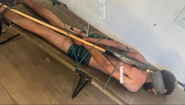 CasviFactory's tweet photo. 𝐌𝐀𝐋𝐃𝐈𝐓𝐀 𝐑𝐀𝐙𝐀

Hombre atado a una tabla, preso de Netanyahu, con amplia difusión en redes sociales, demostrando que el maltrato y la tortura es habitual en Israel

-Tel Aviv reconoció que la fotografía es real, pero no reveló la identidad del hombre ni lugar donde está https://t.co/KAP225bypo