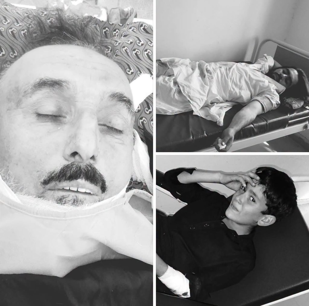 IsmailWazir19's tweet photo. آج ایک بار پھر جنوبی وزیرستان کے لدھا علاقے میں فوج کے ڈرون حملے میں علاقے کے ایک پُرامن پشتون کو قتل کر دیا گیا جبکہ متعدد دیگر زخمی ہوئے ہیں۔
اور اج دوپھر کو شمالی وزیرستان میرعلی تپی گاوٴں میں یاسر کے گھر پر کوڈ کاٹر ڈرون ہوا جس میں یاسر شدید زخمی ہوا اور شمسی پلانٹ اور گھر کو شدید نقصان پہنچا،
ریاستی ادارے روزانہ کی بنیاد پر عام پشتونوں کو قتل کر رہے ہیں، مگر اس کے باوجود بہت سے پشتون ظلم کے خلاف آواز اٹھانے والوں کا ساتھ دینے کے بجائے معمولی ذاتی مفادات کی خاطر ظلم کرنے والوں کے اس نظام کا حصہ بن گئے ہیں۔
اس طرح کے ظلم کا مقابلہ صرف قومی اتحاد کے ذریعے ہی ممکن ہے، اور قومی اتحاد کی راہ میں کسی بھی شکل میں رکاوٹ بننے والا ہر کردار اس ظلم کے آج تک جاری رہنے کا سبب ہے۔
#PashtunLivesMatter
#SavePashtunLives
#StopStateTerrorism