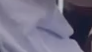AndySanTH's tweet photo. @jonaaronbray Let's say he had a blood squib tube (besides the yes exploding mic) going up to his neck, wouldn't this look like a tube filled with blood being exposed, rushing up to his neck? Possible? Anyone? Or what else could this black thing be? @jonaaronbray #charliekirk https://t.co/A5LGx0c9sw