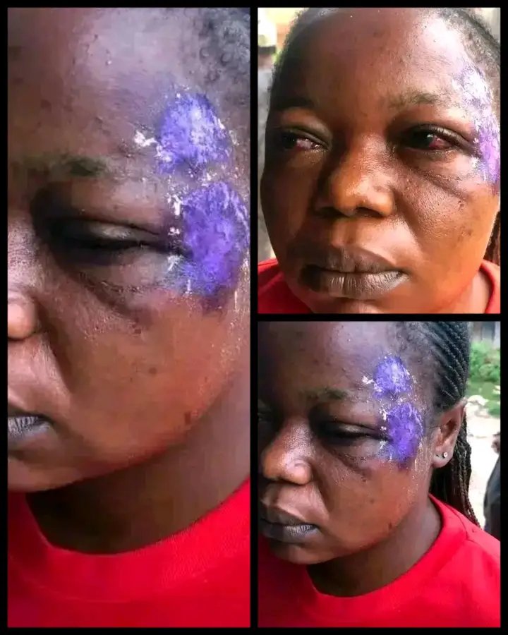 Prince_dc21_'s tweet photo. In this country called Nigeria we've become so evil that once it's not affecting us then it's none of our business.

"I was about to go to bed on Thursday night, when i heard a terrifying noise coming from my neighbor's house.

My husband had traveled. i was alone with the kids, they had also gone to bed. i had just finished my night prayer. I immediately left the bed & peeped through the window. I noticed 2 guys dressed in black standing outside of the apartment. I tried to see if i could recognize any but they were in masks, the other 3 were inside obviously b-t!ng my neighbor, his wife & kids intimidating them to bring out money.

i realized my neighbor was being robbed. I knew i had to do something to help. So, i immediately screamed at the top of my voice trying to alert the whole neighborhood & also calling out for help. Unfortunately, My shout instead led them to my own apartment. They all left my neighbor's apartment & broke into mine, blindfolded me, led me out of the house & bt me, I was screaming for my life which i believe other neighbor's heard but nobody came for my rescue. They had to keep me mute as they continued b-t!ng me

After everything, they took my phone, some house properties including all money i had managed to save up as capital to be added to my shop for Christmas market & also took me to the bush & left me there unconscious. I slept in the bush until morning. When i woke up & realized myself there. I don't want to cry. I don't know what to say. I only wanted to help but when it got to my turn when i needed help everyone ignored. I've learned my lesson. I just want to thank God I'm still alive & that they didn't touch any of my daughters. Pls. help Me thank God for saving my life. I'm greatful father🙏🏼"