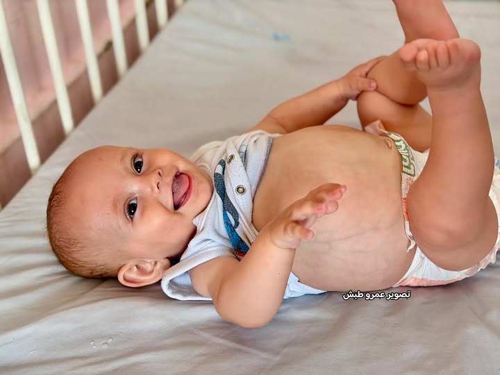 Timesofgaza's tweet photo. Seven-and-a-half-month-old infant Rawda Abu Zarqa is suffering from several life-threatening medical conditions, including an enlarged liver, severe growth failure, feeding difficulties, and serious blood sugar instability, with doctors also suspecting a rare inherited metabolic disorder.
Doctors stress that her condition requires urgent specialized diagnostic tests and treatment that are unavailable in the Gaza Strip, making her immediate medical transfer outside Gaza essential to save her life.