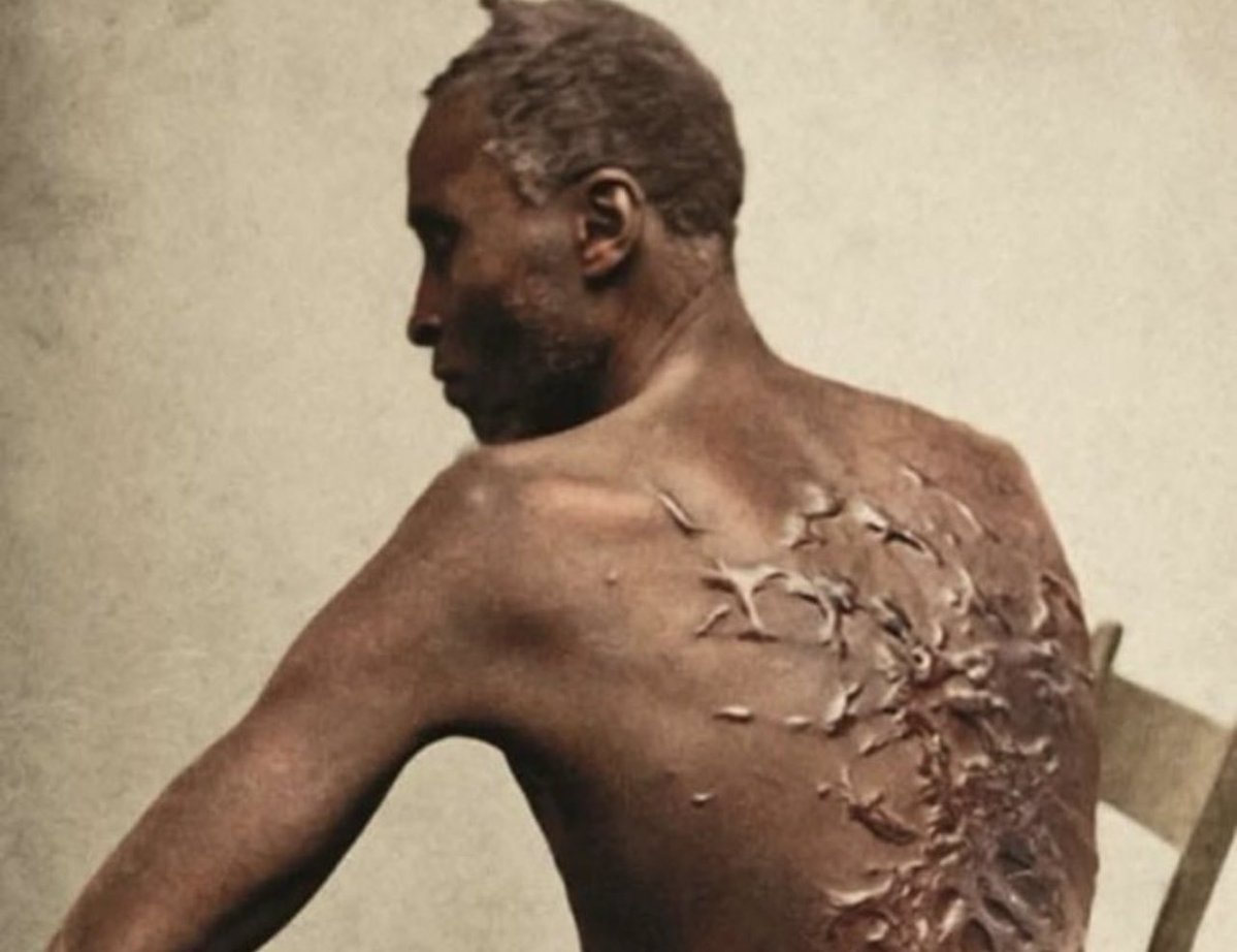 Theveripost's tweet photo. Escaped enslaved man, Gordon, also known as 'Whipped Peter,' shows the scars on his back in Louisiana, 1863. The Trump administration ordered the removal of this photo, along with other signs and exhibits related to slavery, from several national parks. https://t.co/vgGz8KqfOn