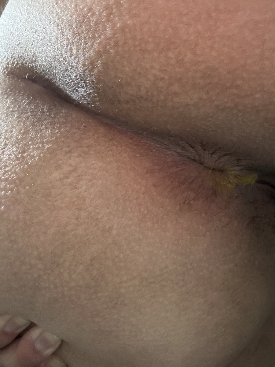 Latinab00ty01's tweet photo. $5 dick rates today only!!!! https://t.co/gVHNGtMxZ4