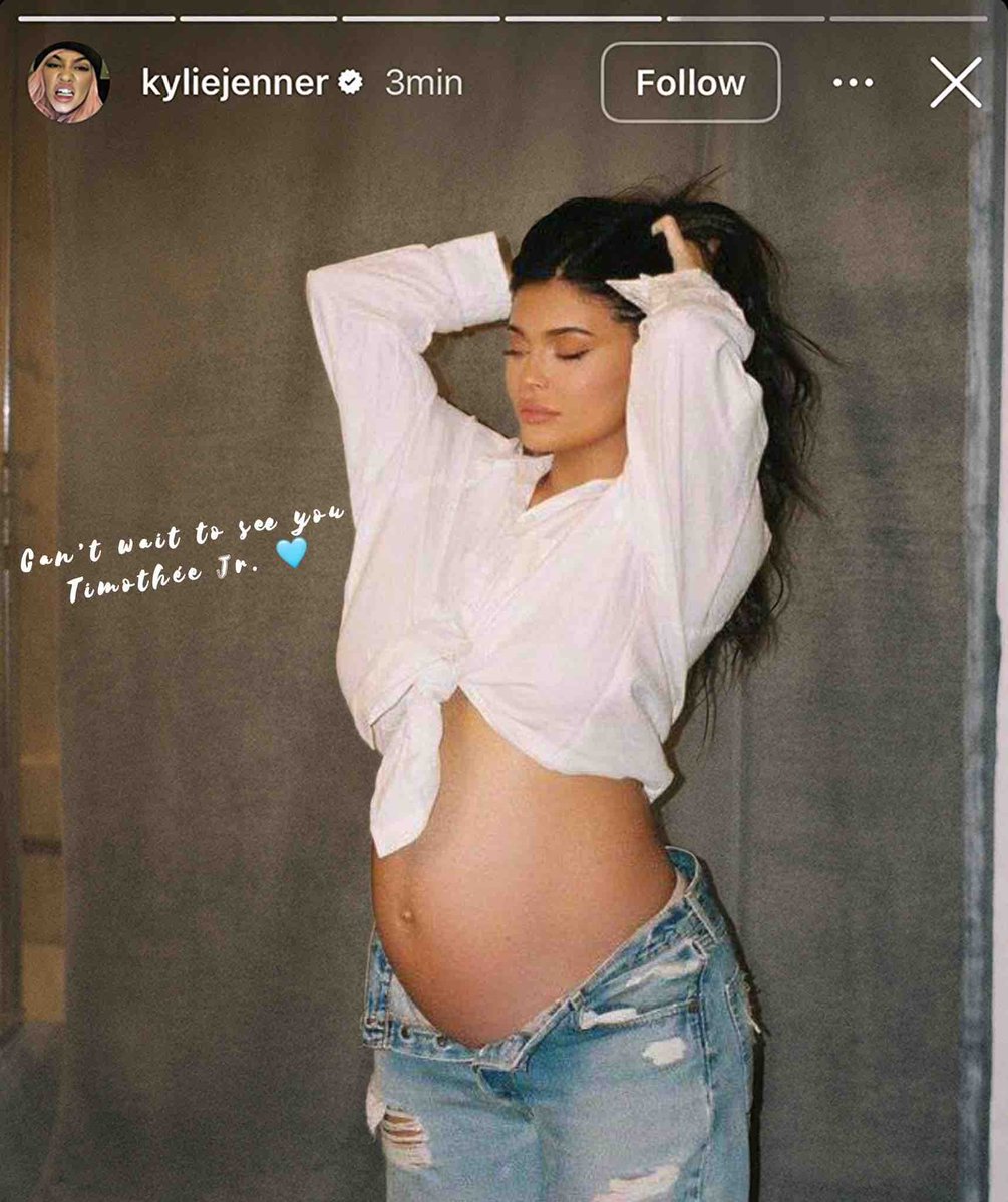 BuzzCrave_'s tweet photo. Kylie Jenner announces she's pregnant and names the baby after Timothée Chalamet.

"Can't wait to meet you Timothée Jr. 🩵" https://t.co/f0i9wIjn1Z