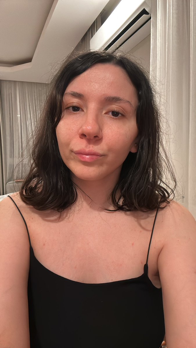 sevval_salci's tweet photo. Avutuyorsun kendini bebeğim avutuyorsun ;) anlık ben bu arada no filtre no make up dememe gerek yok heralde zaten belli ;) https://t.co/gcpdXbKxS2