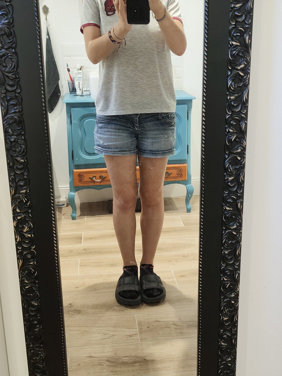 Call_Me_Mon_Roi's tweet photo. Those shorts are such liars my legs does not look that skinny https://t.co/jm3Fq32iNg