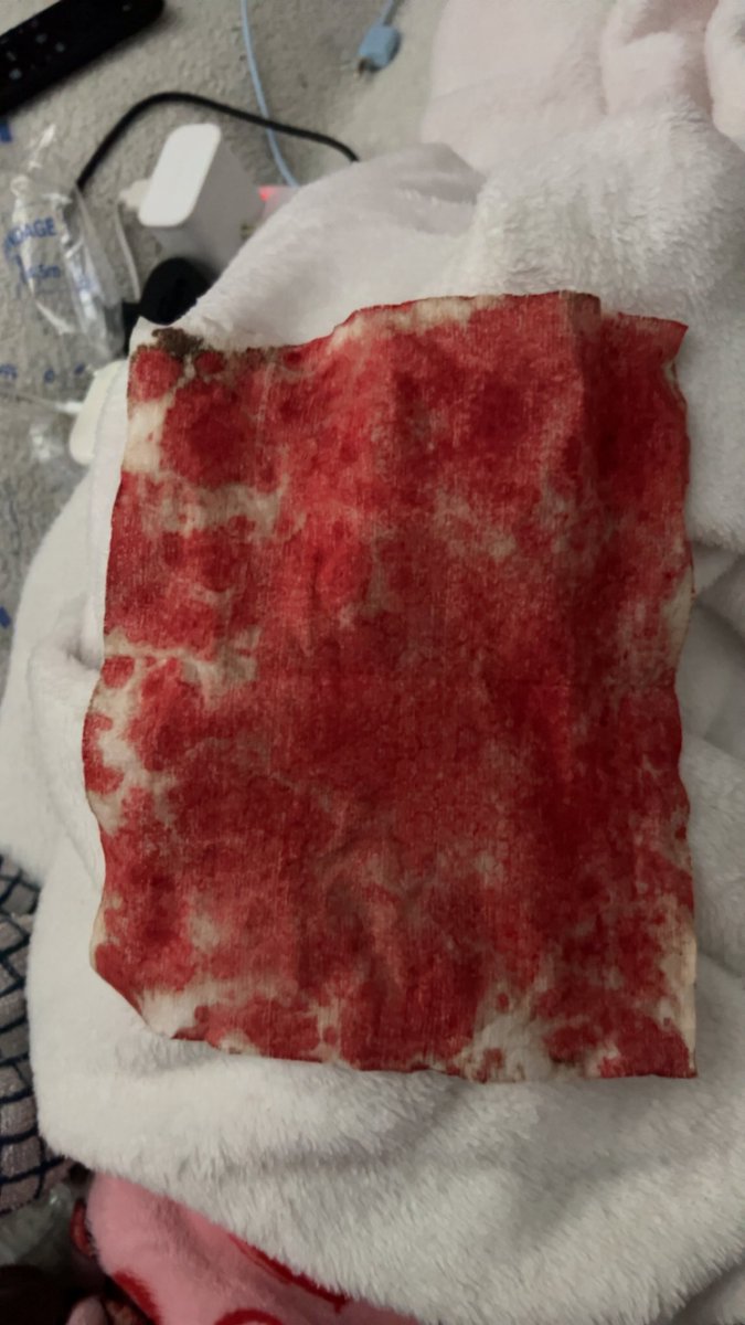 kadief7lp's tweet photo. fake sfx makeup
fake blood
#shtwt #slashflash #shedtwt #slittwt https://t.co/jzwA3s7neM