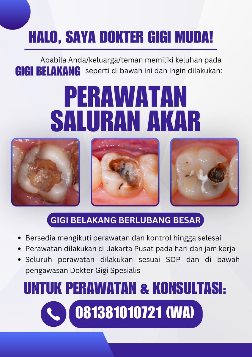 nlndiva's tweet photo. Bagi yang punya keluhan gigi belakang berlubang besar dan ingin dilakukan PSA, boleh hubungii aku untuk perawatan/konsultasi yaa! *\(^o^)/*
☎️ 081381010721

#koasgigi #koasgigijakarta #perawatangigigratis #caripasien #psagigi #perawatansaluranakar #caripasienkoasgigi #koaslife https://t.co/GghHarEqQW
