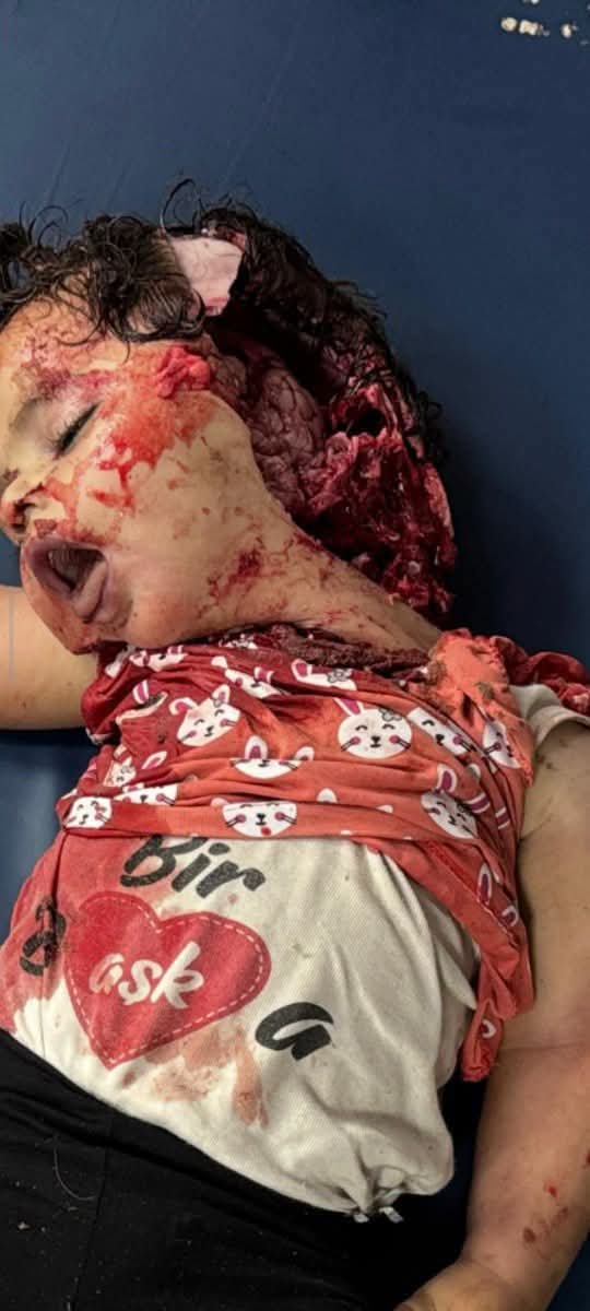 mohammed_senwar's tweet photo. لا حول ولا قوة إلا بالله 
حسبنا الله ونعم الوكيل 
بأي ذنب قتلت 

هل هذا هو بنك أهدافهم 
أين أصحاب الضمائر الحيه من هذه المشاهد
والله لو قتل حيوان في دولة من دول الغرب
لقامت الدنيا وما قعدت

اللهم انتقم لهذه الدماء https://t.co/7q6DqAgWQ0