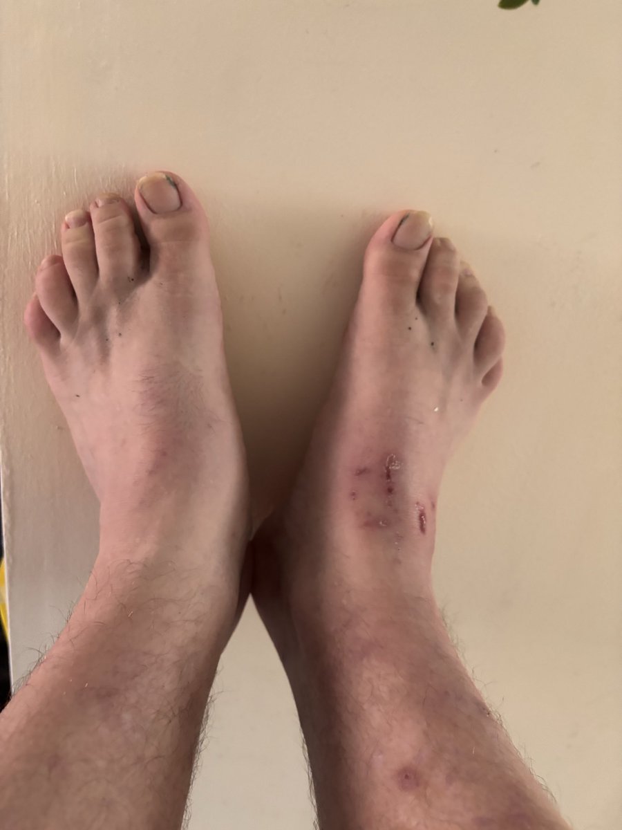 MrAdamChell's tweet photo. Come and DM here for custom feet 😜 https://t.co/pa0diGyqV2 https://t.co/RxrTMt5oag