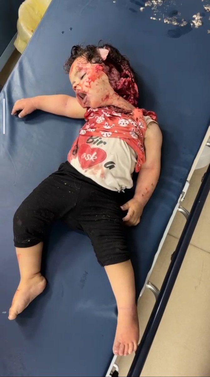Salah_PS818's tweet photo. What was this little girl's crime?
She deserved to grow up, to laugh, to dream, and to be safe—not to lose her life.
No child should pay the price of war.
May she rest in peace, and may every innocent child be protected. 💔🇵🇸
#GazaGenocide #save_child https://t.co/QmXsk3BHUm