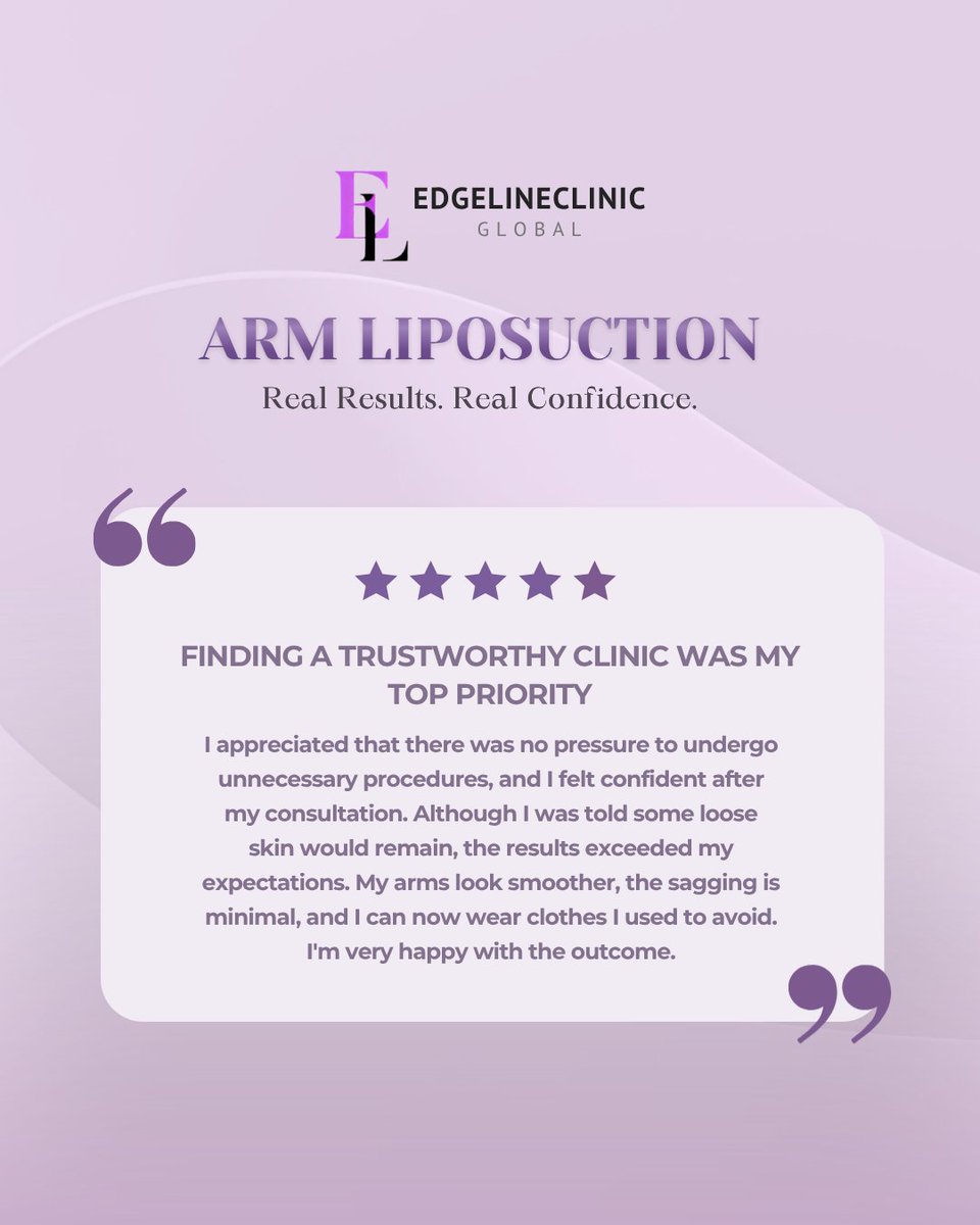 edgeline_global's tweet photo. Can you spot the difference? 

A more refined upper-arm contour and a smoother overall silhouette 

Book now
WhatsApp: +82 10 3970 2135
Email: edgelinegangnam@naver.com
WeChat: edgeline_gangnam
LINE: @343tnxkn

#armliposuction #bodycontouring #korealiposuction  #beforeandafter https://t.co/cdvSmyBf86
