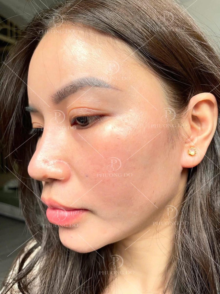 NguyenVi0101's tweet photo. Ngắm da đẹp để lấy động lực làm đẹp nha các chị mình ơi! 
Trẻ hoá da liền các chị ơi https://t.co/8ukHHBN11f