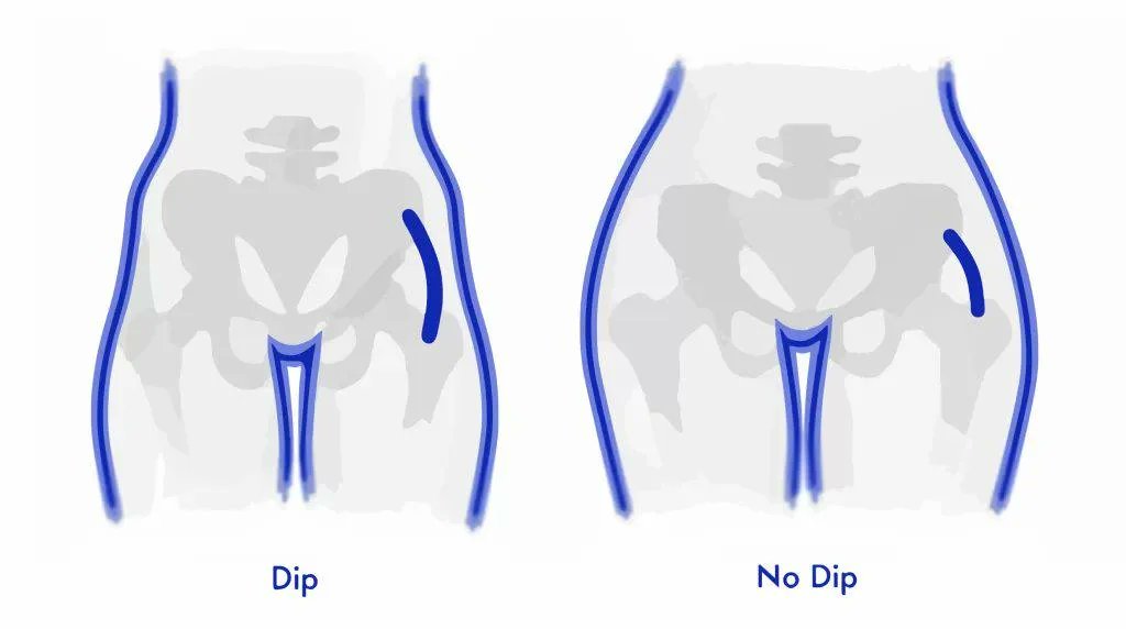 BrianAtlas's tweet photo. Hiplet trend of men refusing to date women with hip dips is INFURIATING women. If it’s okay for women to have a height preference, it’s okay for men to prefer to date women without hip dips. https://t.co/8qsPwb8SKi