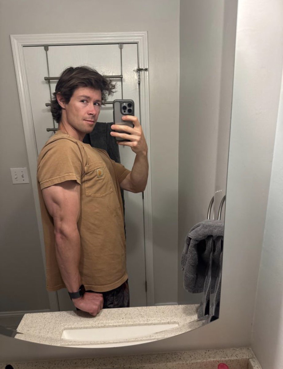sibaburck's tweet photo. my noodley vegan arms https://t.co/zMo6qKDk1o